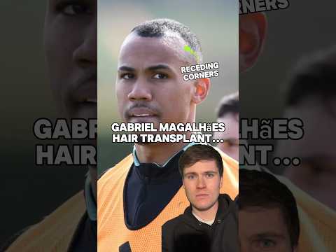 Gabriel Magalhães hair transplant! 🔥