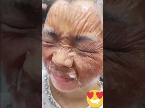 Get Spotless & Glowing Skin | Remove Dark Spots & Pigmentation In 7days #beautiful #shorts #viral