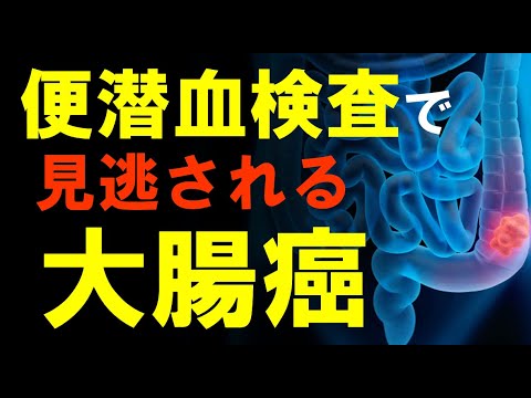 【知らないと致命的】便潜血検査をパスしても大腸癌で命を落とす事があるという事実