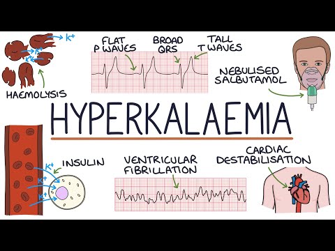 Understanding Hyperkalaemia (High Potassium)