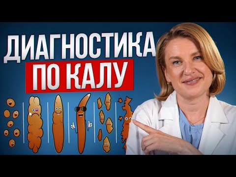 Самодиагностика здоровья по стулу / Проверь свой кишечник за 5 МИНУТ!