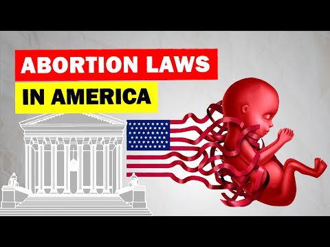 Full History of Abortion Rights and Laws in America