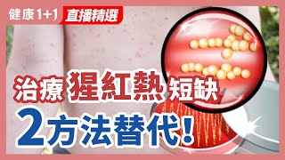 治療猩紅熱短缺  2方法替代！| 健康1+1 · 直播精選