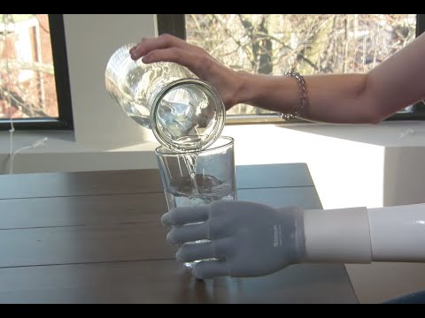 A Prosthetic Limb Innovation