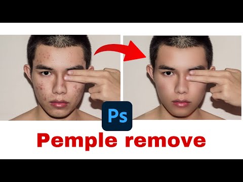 How to remove pemples in photoshop 💥 #photoshop #tutorial #editingtutorial #youtube