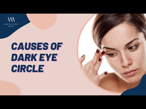 What Causes Dark Eye Circle?