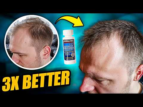 Minoxidil Not Working? - Try THIS for MORE hair growth!