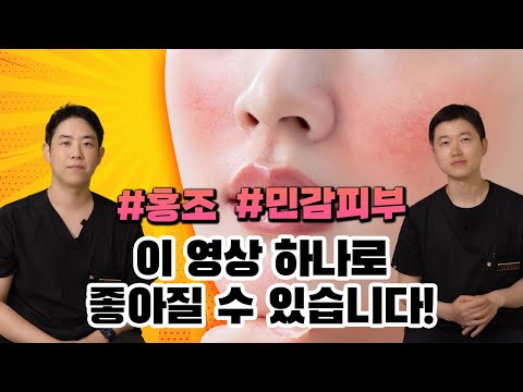 홍조, 민감성 피부의 모든 것│#홍조