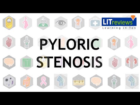 Pyloric Stenosis