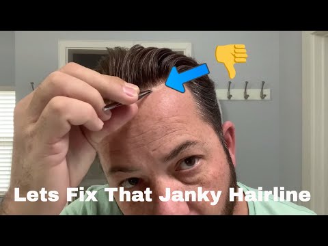 Lets Fix That Old Hairline On Your Hair Replacement Or Hair System