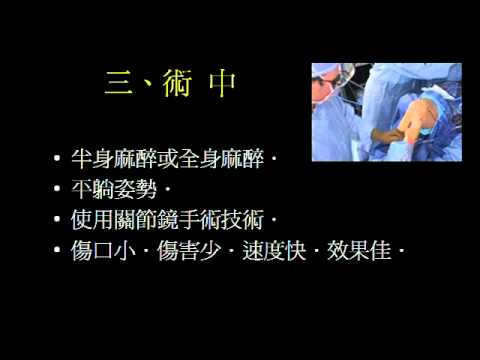 關節鏡手術相關知識