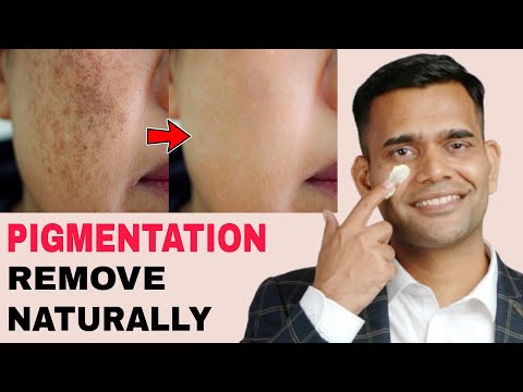 Get Rid Of Pigmentation, Darkspots | Remove Pigmentation in Just 2 Steps