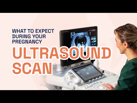 Pregnancy Ultrasound Scan: What to expect!