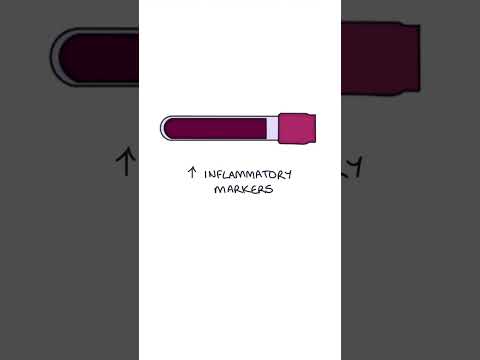 Polymyalgia rheumatica explained #medicine #medicalstudent #rheumatology