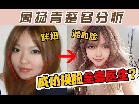 颜值分析：周扬青成功变“混血美女”，竟然是因为“底子好”！？整容分析究竟哪种才算整形基础好！ 【陪整日记】