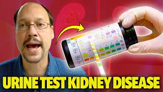 Urine Test For Kidney Disease (Protein In Urine) At Home Kidney Test. How To Use Urine Test Strips?