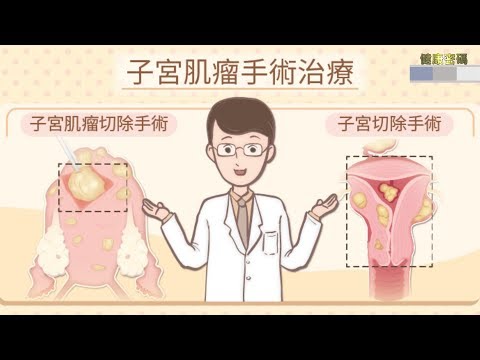 【子宮肌瘤】月經一來經血量都超多的不到一小時就要換衛生棉