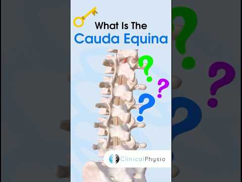 Cauda Equina #anatomy #physiotherapy #physicaltherapy #caudaequina