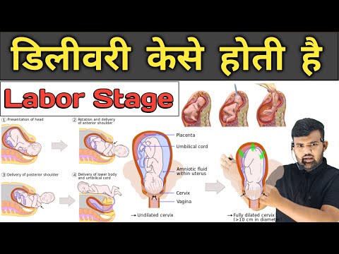 डिलीवरी केसे होती है | Labor Stage | Pregnancy | Medicine | Treatment | Hospital Knowledge | Doctor