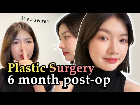 SIX MONTHS REVIEW...😳 | Braun Plastic Surgery