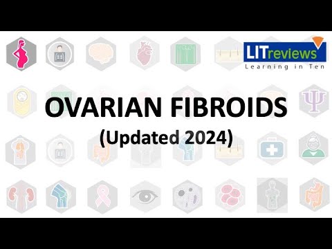 (New) Ovarian Fibroids