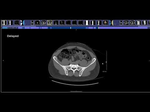 How to read a Body CT for Trauma