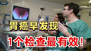 哪些症状，能早期发现“胃癌”？医生却说：日本的经验值得学习！