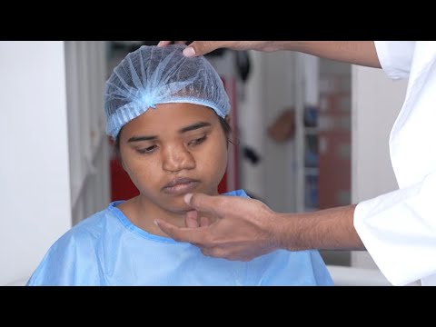 Unbelievable Nose surgery by Dr. Sunil Richardson