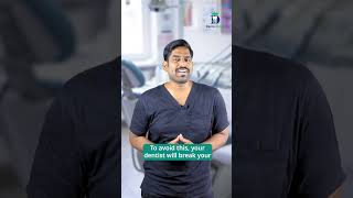 ஞானப் பல்லை ஏன் உடைக்கிறார்கள்? Sectioning of wisdom teeth | Dr.Karthikeyan | Denta Kings