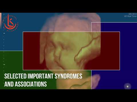 Fetal Syndromes Masterclass - Brussels 17 August 2019