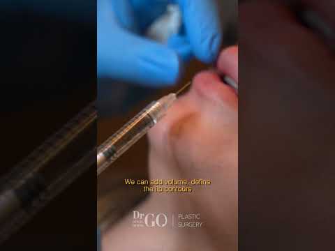 Behind the Scenes: A Day of Filler Procedures with Assoc. Prof. Dr. Güncel Öztürk