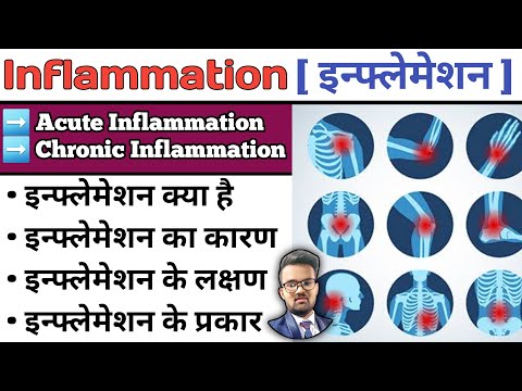 Inflammation | Inflammation and Infection | Inflammation Pathology | Inflammation in Hindi