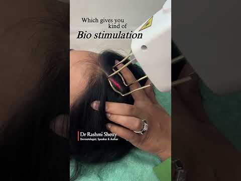 Laser hair stimulation By Dr Rashmi Shetty