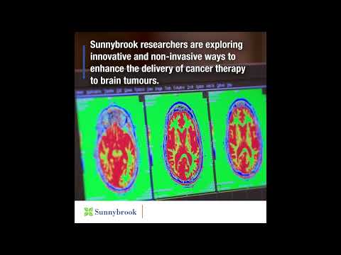 Focused Ultrasound (FUS) | Sunnybrook Health Sciences Centre