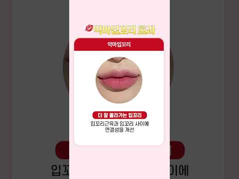 로렌의 노메스입꼬리필러💋VS입꼬리결찰법 차이는? #shorts