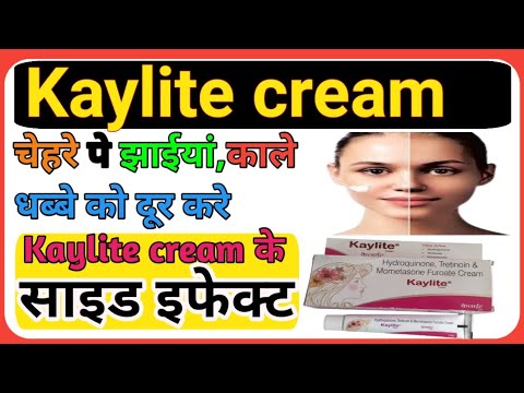 Kaylite Cream के side effect देखने के बाद हर कोई इस क्रीम को लगाएगा,Side effects of kaylite crem