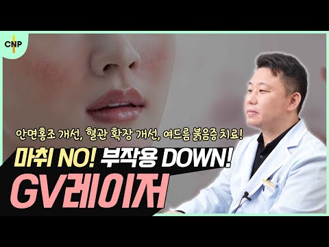 GV레이저로 붉어진 피부를 매끈하고 투명하게 만드는 방법 대공개!