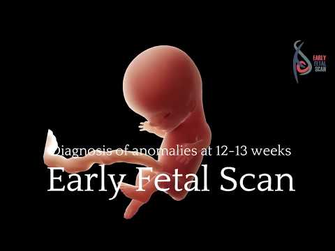 What is Early Fetal Scan?