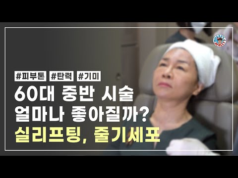 5060 , 어떤 시술이 필요할까? 실리프팅 , 줄기세포 , 리프팅 시술 및 전후 공개 !