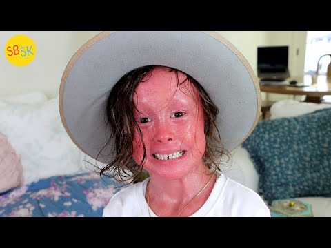 A Kid with Skin Growing Too Fast (Harlequin Ichthyosis)