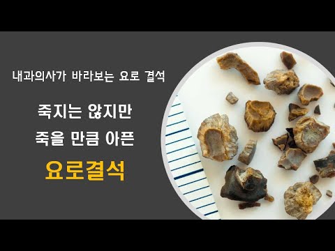 요로결석 (1) 죽을만큼 아픈 요로 결석 : 요로 결석 증상 치료 내과의사가 바라 보는 요로 결석