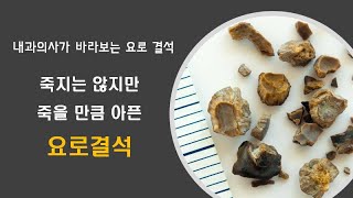 요로결석 (1) 죽을만큼 아픈 요로 결석 : 요로 결석 증상 치료 내과의사가 바라 보는 요로 결석