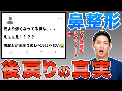 【鼻整形】鼻中隔延長を受けても後戻りすることはあり得るのか