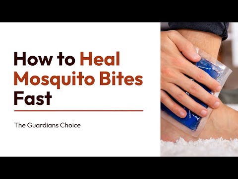 3 Easy Ways to Heal Mosquito Bites Fast | How to Heal Mosquito Bites Fast | The Guardians Choice