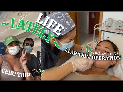 LIFE AFTER MECQ (Got An ALAR TRIM OPERATION + Flew To Cebu!)