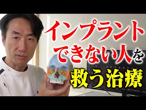 頬骨にインプラント!?日本で25人の歯医者だけができる治療【ザイゴマ】