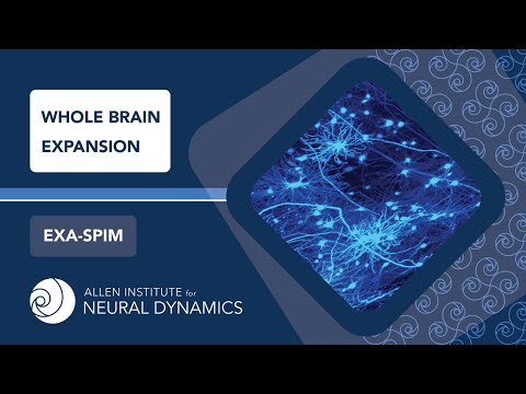 Whole Brain Expansion | Exa-SPIM