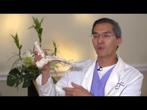 Ask The Doctor with Dr. Randy Lew - What is Plantar Fasciitis?