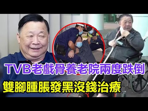 76港星秦煌近況曝光，住養老院兩度跌倒，雙腳腫脹發黑，沒錢治療聲稱會自愈，替長女10年還300萬換來絕情　老來一貧如洗靠綜援住護老院!