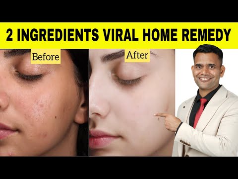 Try This 2 ingredients Viral Home Remedy For Spotless, clear,  Glowing Facial Skin